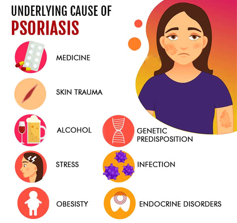 Dermax™ Psoriasis Treatment Spray