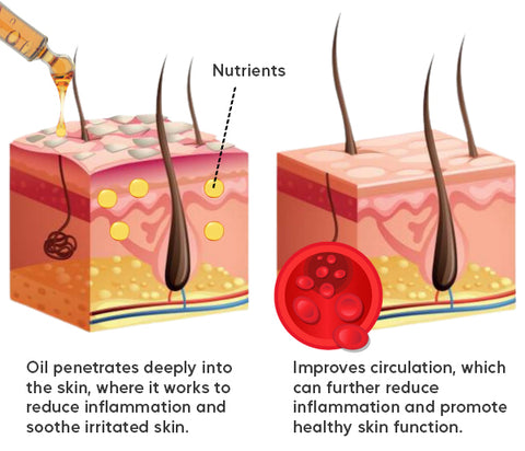 AEXZR™ Psoriasis Cure Essential Oil