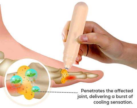 AEXZR™ Roll-On Cooling Gout Cure