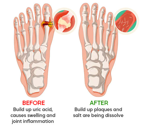 AEXZR™ Roll-On Cooling Gout Cure