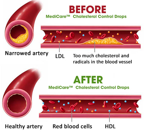 MediCare™ Cholesterol Control Drops