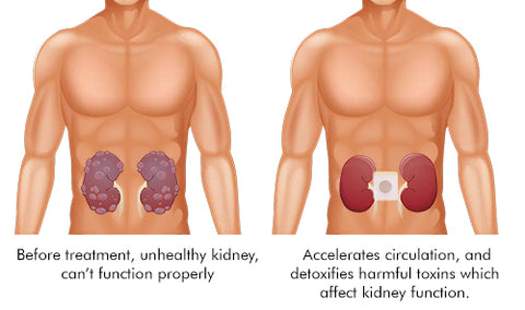 Biancat™ VitalBoost Kidney Care Patch