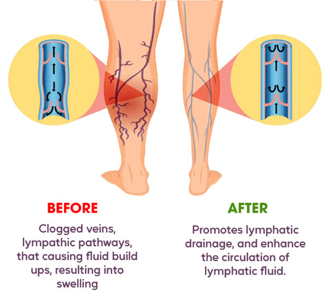 LymphCare™ Anti-Swell Medicinal Drops