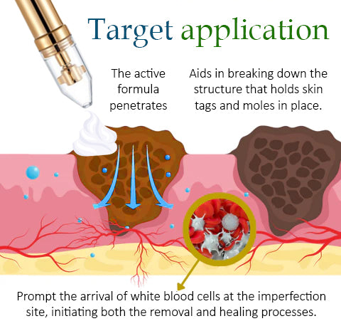 SkinFix™ Tag & Mole Remover