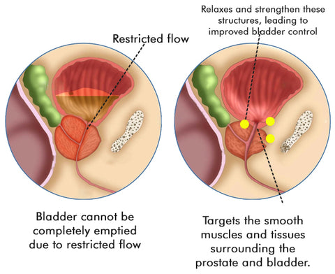 CC™ Prostate Treatment Drops 