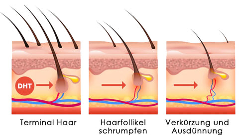 AEXZR™ Haarwachstum & Reparatur-Essenz