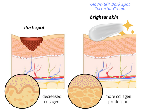 GloWhite™ Dark Spot Corrector Cream