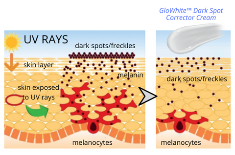 GloWhite™ Dark Spot Corrector Cream