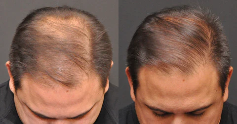 AEXZR™ Scalp & Hair Revive
