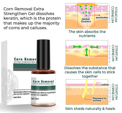 Corn Removal Extra Strengthen Gel