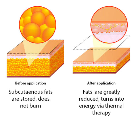 FitLock™ Herbal Slimming Patch