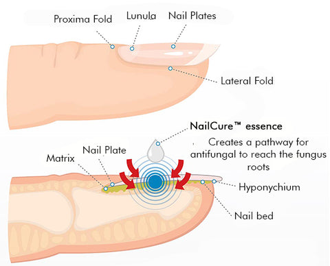 NailCure™ Fungi Treatment Pen