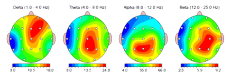 Brain Maps - EEG