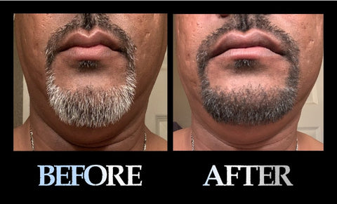 blackbeard for men before and after photo