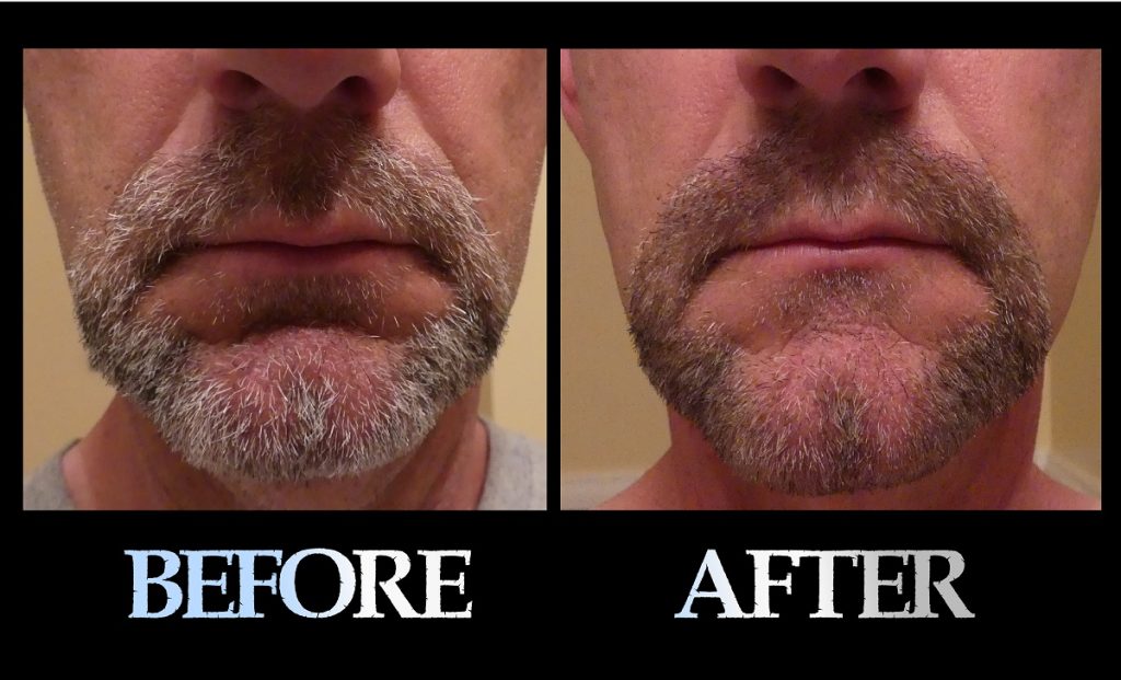 Blackbeard For Men before and after photo