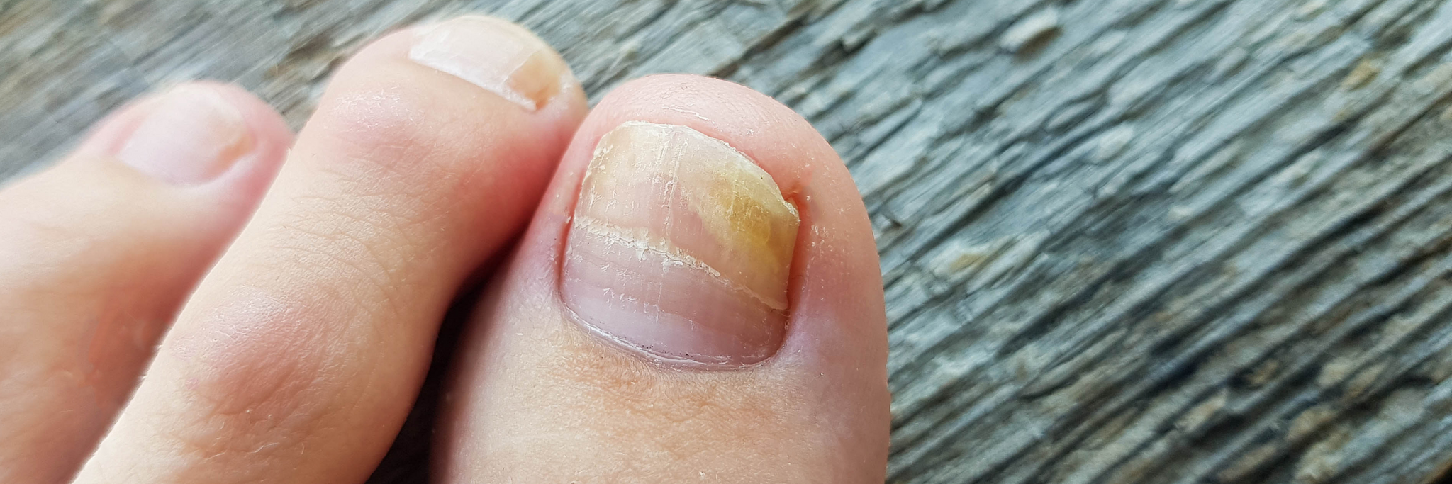TEN NAIL PROBLEMS THAT CAN SAY SOMETHING ABOUT YOUR HEALTH – Weekly SA  Mirror