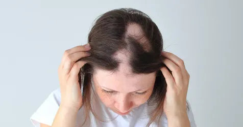 Women 100% Vegan Caffeine Anti Alopecia Fast Growth Hair Oil 