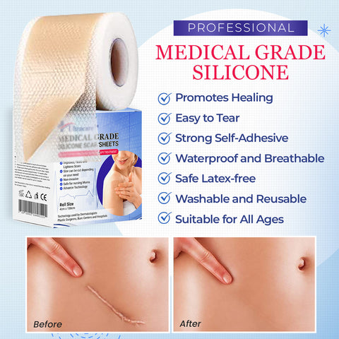 Ultracare™Medical Grade Silicone Scar Sheets