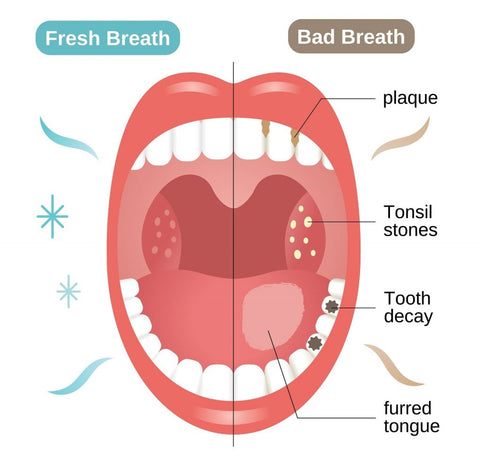 TeethPro™ Mouthwash 