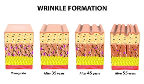 LineLess™ Forehead & Between Eyes Wrinkle Patch
