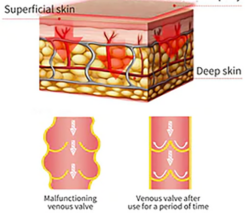 VascuClear™ Vein Therapy Cream