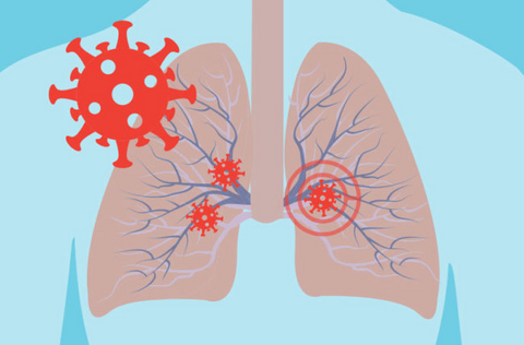 HerbClear™ Organic Herbal Lung Cleanse Repair Nasal Spray