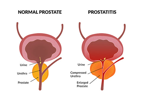 Royalprestige™ Prostatitis Relief Cream