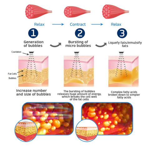 Microcurrent Belly Toning Wrap