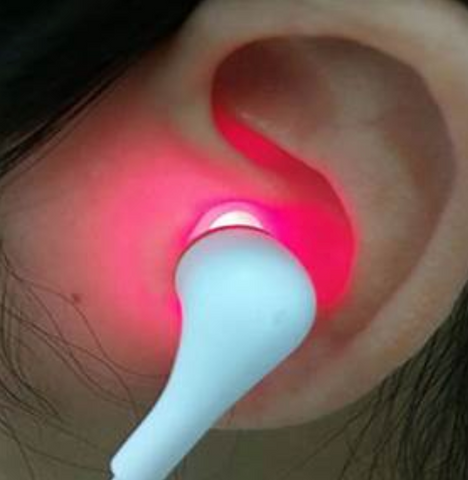 SonoPro™ Tinnitus Ear Laser Therapy Earplug