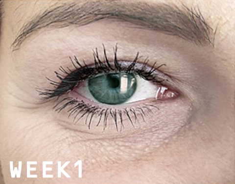 Anti-Wrinkles Micro-needle Under Eye Patch