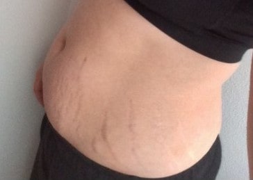 EarthBlend™ Stretch Mark Vanisher