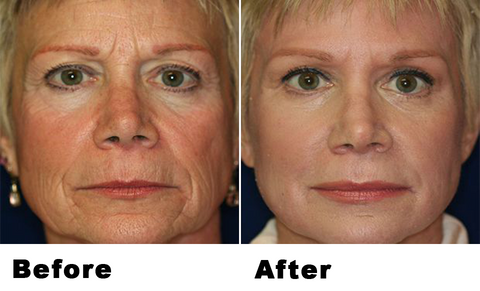 Anti-Wrinkle Collagen Repair Wash-Free Sleeping Mask