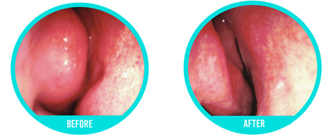 Spray nasali Dr.Nose™