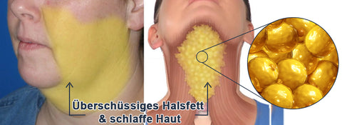 GFOUK™ EMSculpt Schlafendes V-Gesicht Schönheitsgerät