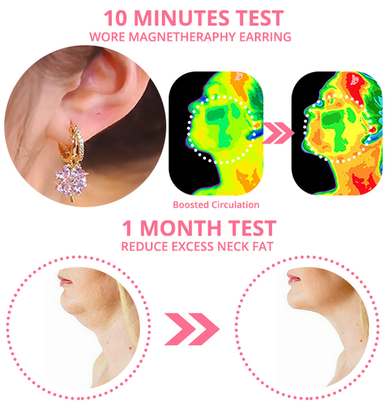 flysmus™ MagneTherapy Lymphatic Germanium Earrings 