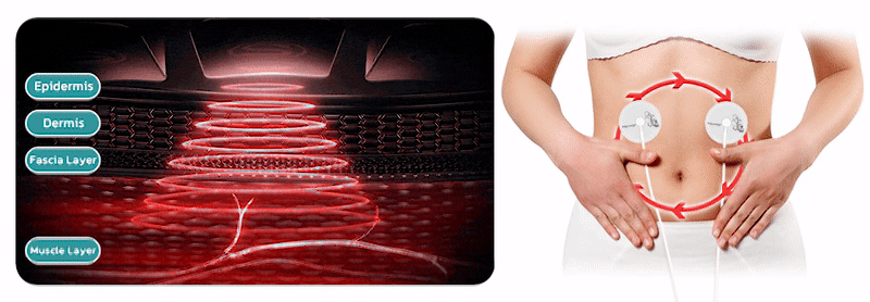 EMS Pocket Bioelectric Acupoints Lymphvity Massager Pads 
