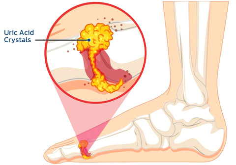 Oveallgo™ Bee Venom Joint & Bone Therapy Spray