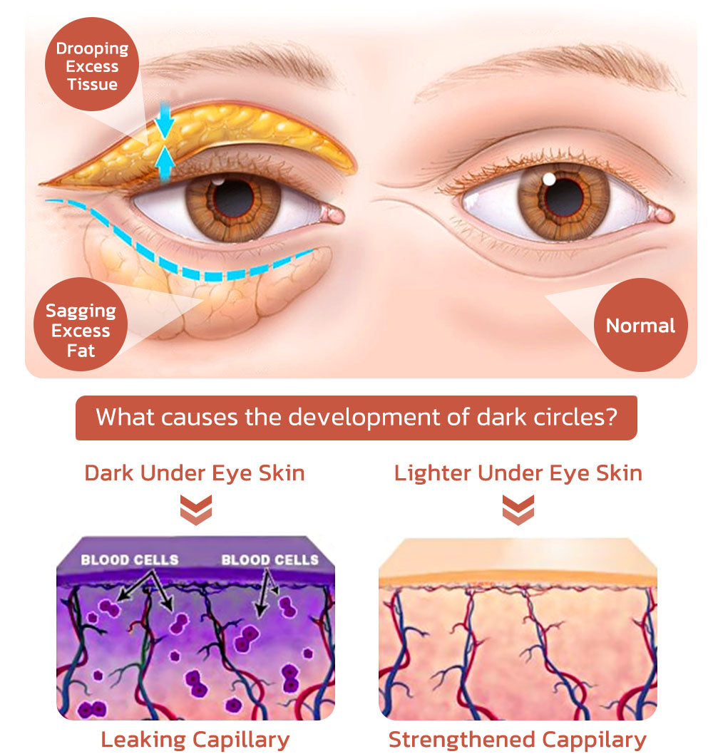 flysmus™ CaffeineEYES Repair and Lifting Augencreme