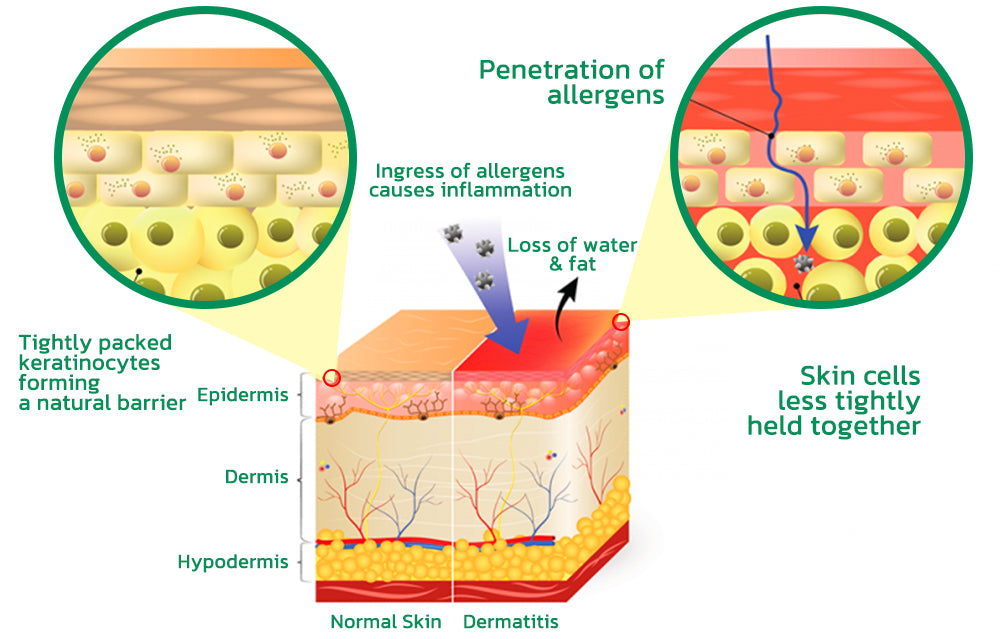 EczmoTherapy Herbal Healing Cream