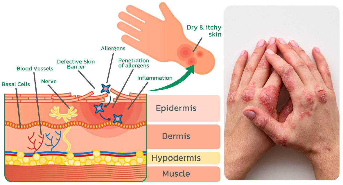 EczoTherapy Herbal Hydration Cream
