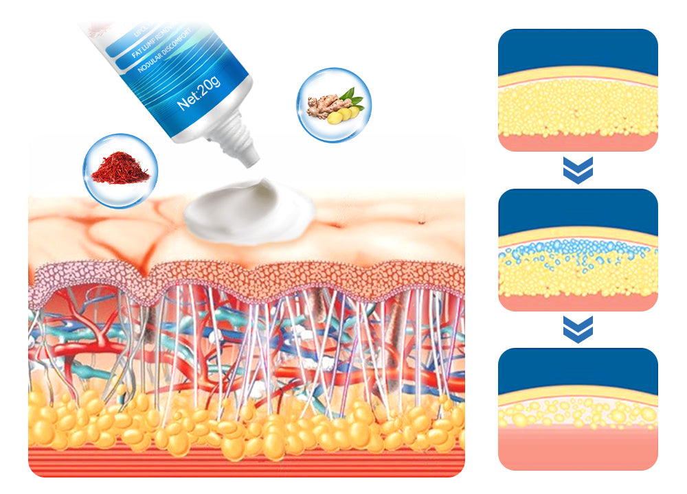 Herblymph Lipomheilung Removing Cream