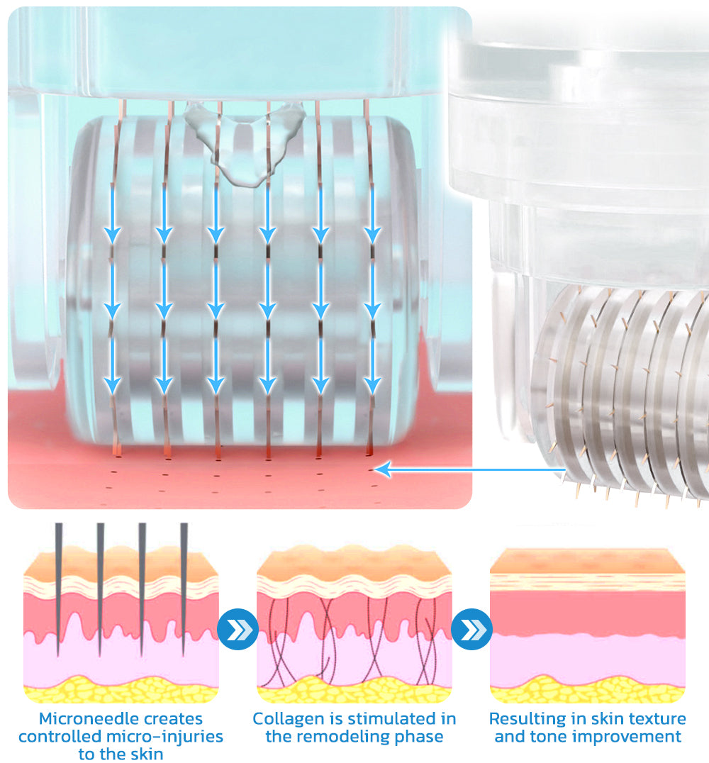 flysmus™ PockmarksHeal Hyaluronic Acid Microdart Roller