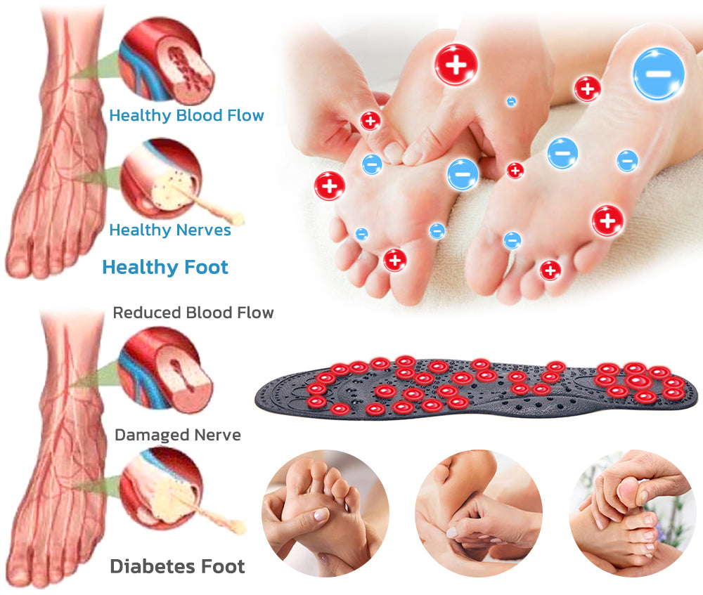 GFOUK™ TitanVein Fern-Infrarot-Turmalin-Akupressur-Einlagen