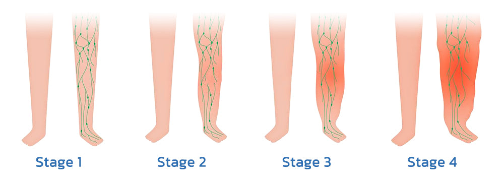 Peranti Pengurut Leher EMS Acupoints Lymphvity