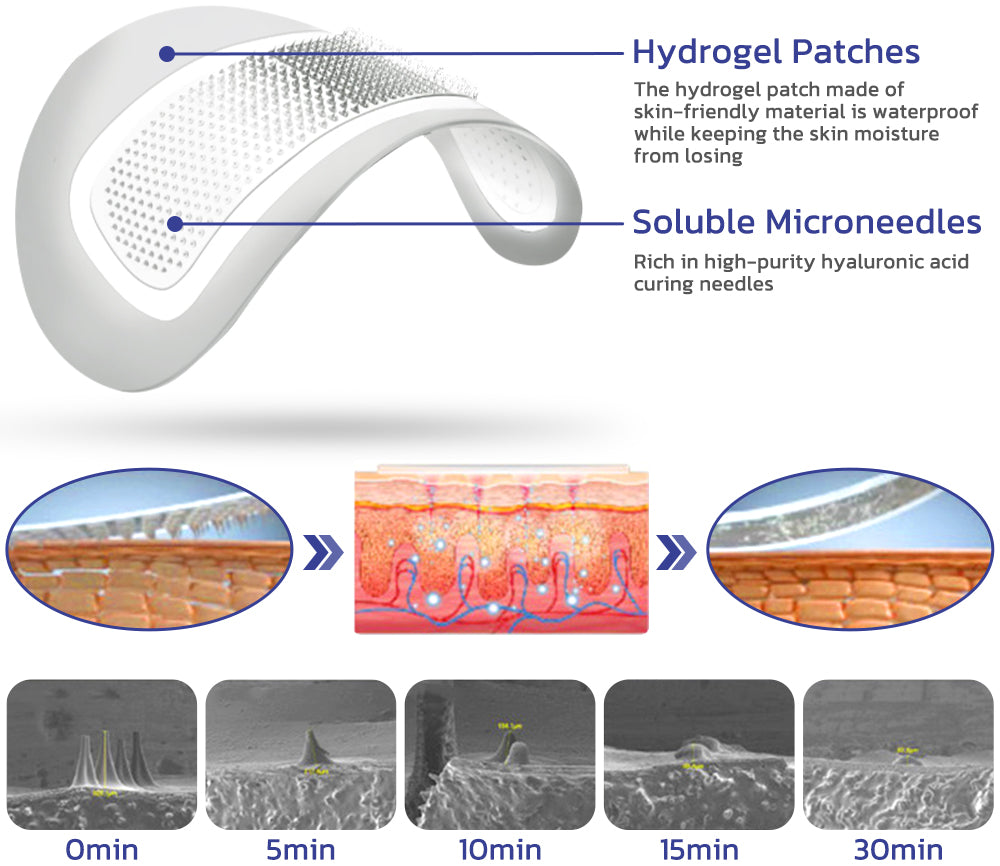 flysmus™Targetline Hyaluronic Acid Micro Dart Patches