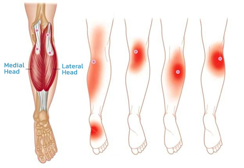 HeatWave™ Compression Knee Brace