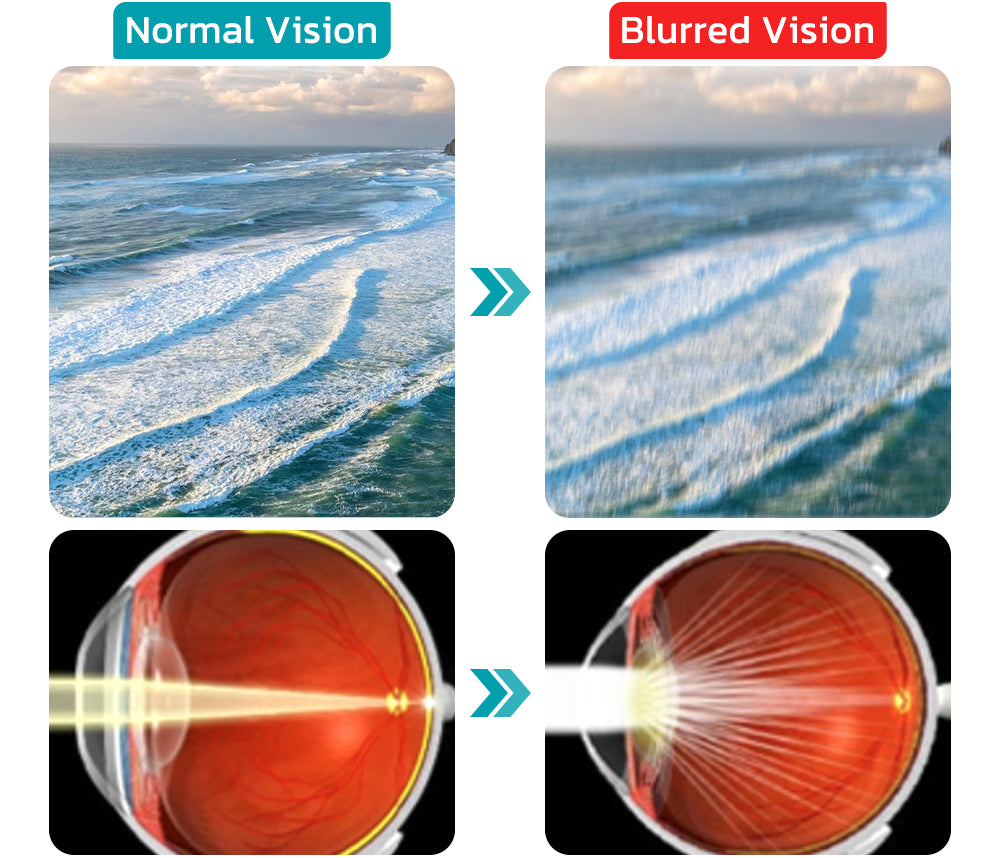 AAFQ™ Precision OphthlaMed Vision Ningkatkeun Patch