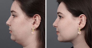 flysmus™ Lymphvity MagneTherapy Germanium Earrings