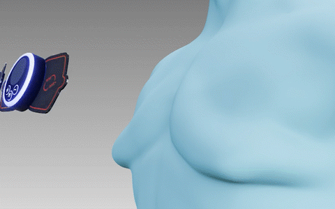 GFOUK™ EMS 男性乳房发育症减少按摩器