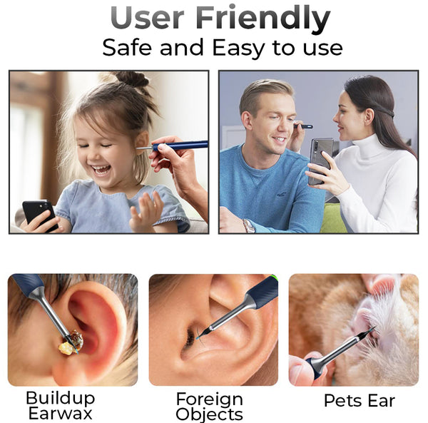 GFOUK™ WiFi 1080HD Visible Earwax Remover